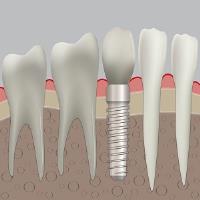 Avondale Dental Clinic image 1